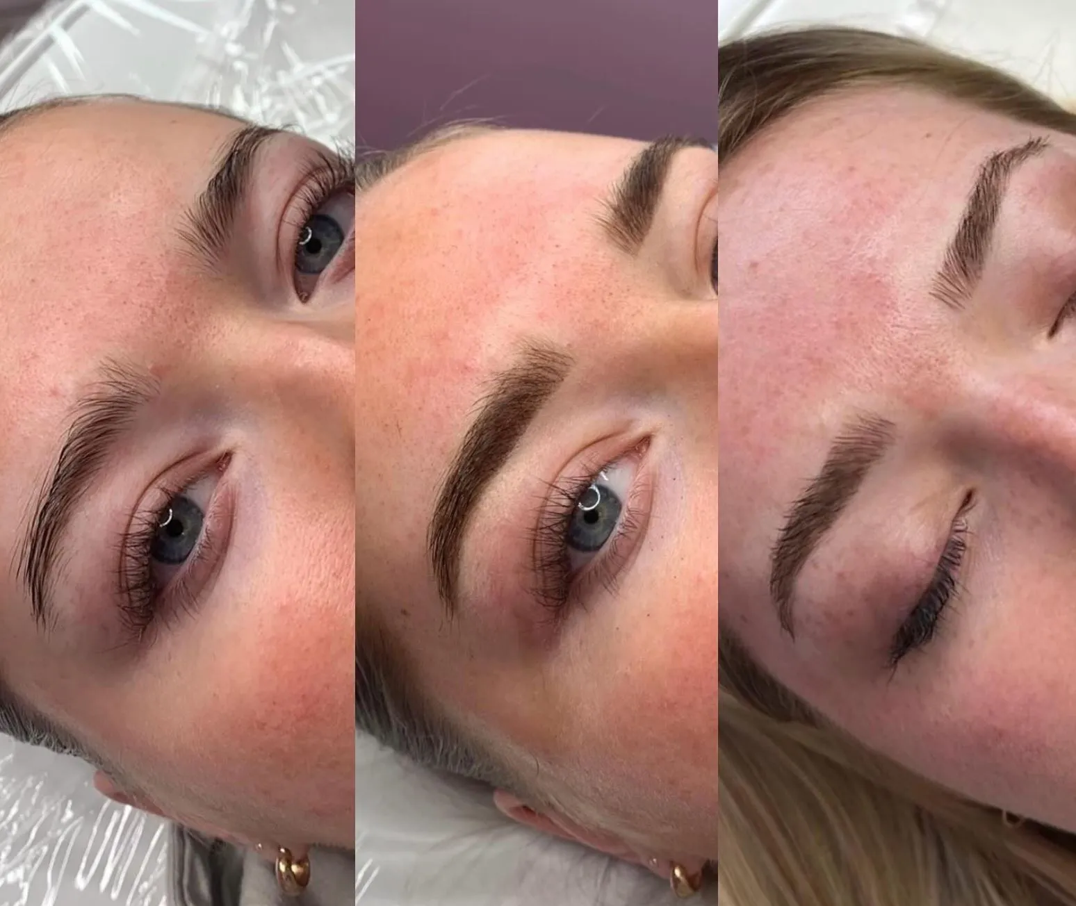 Step-by-Step Aftercare Using Cream (Timing Matters!)