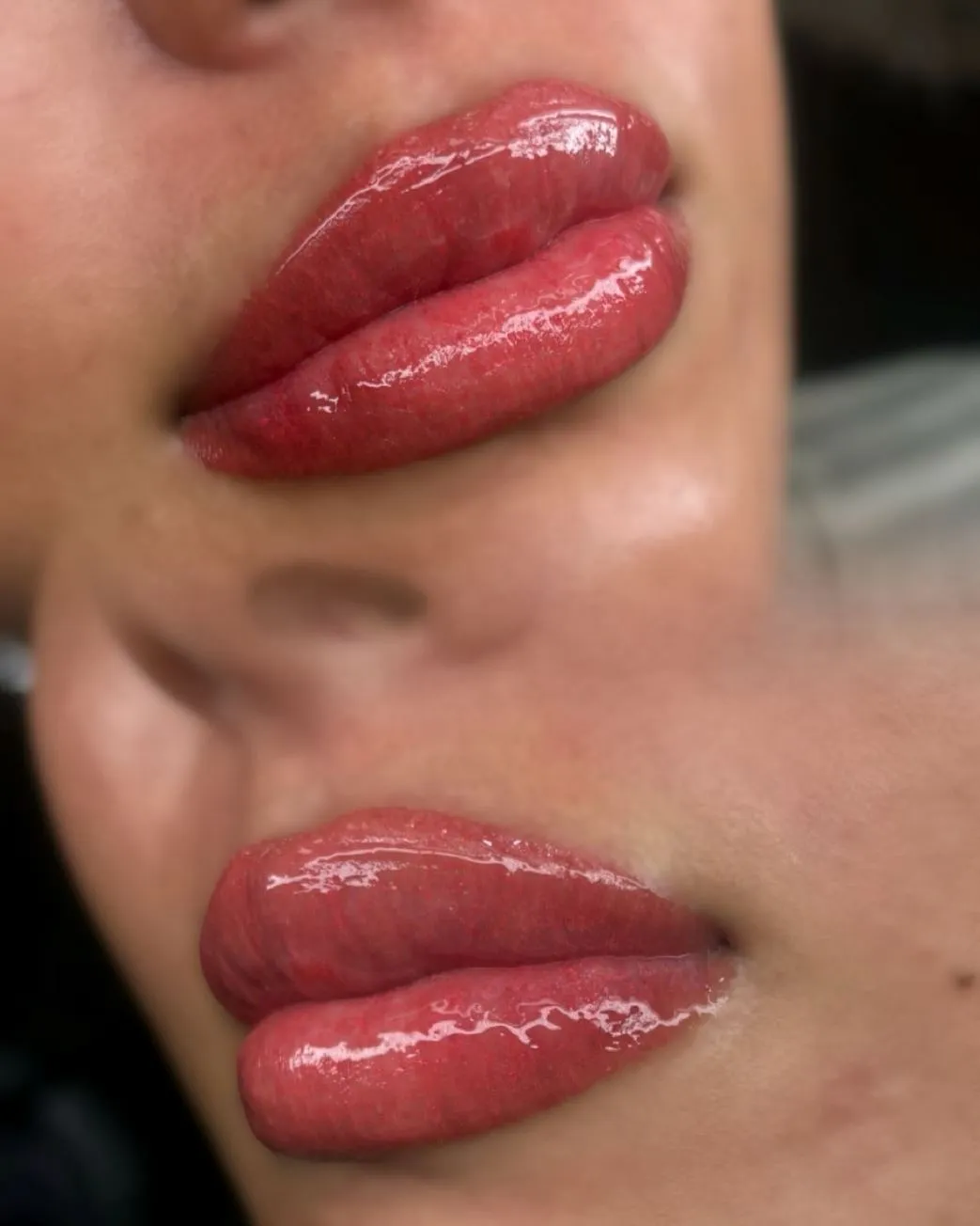 New Age Auto Store | Dark Lip Neutralization Risks Melbourne Swelling and Tenderness