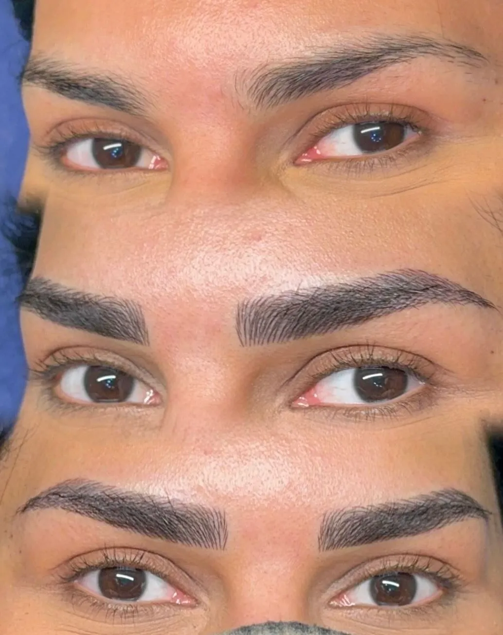 Why Melbourne Skin Reacts Differently